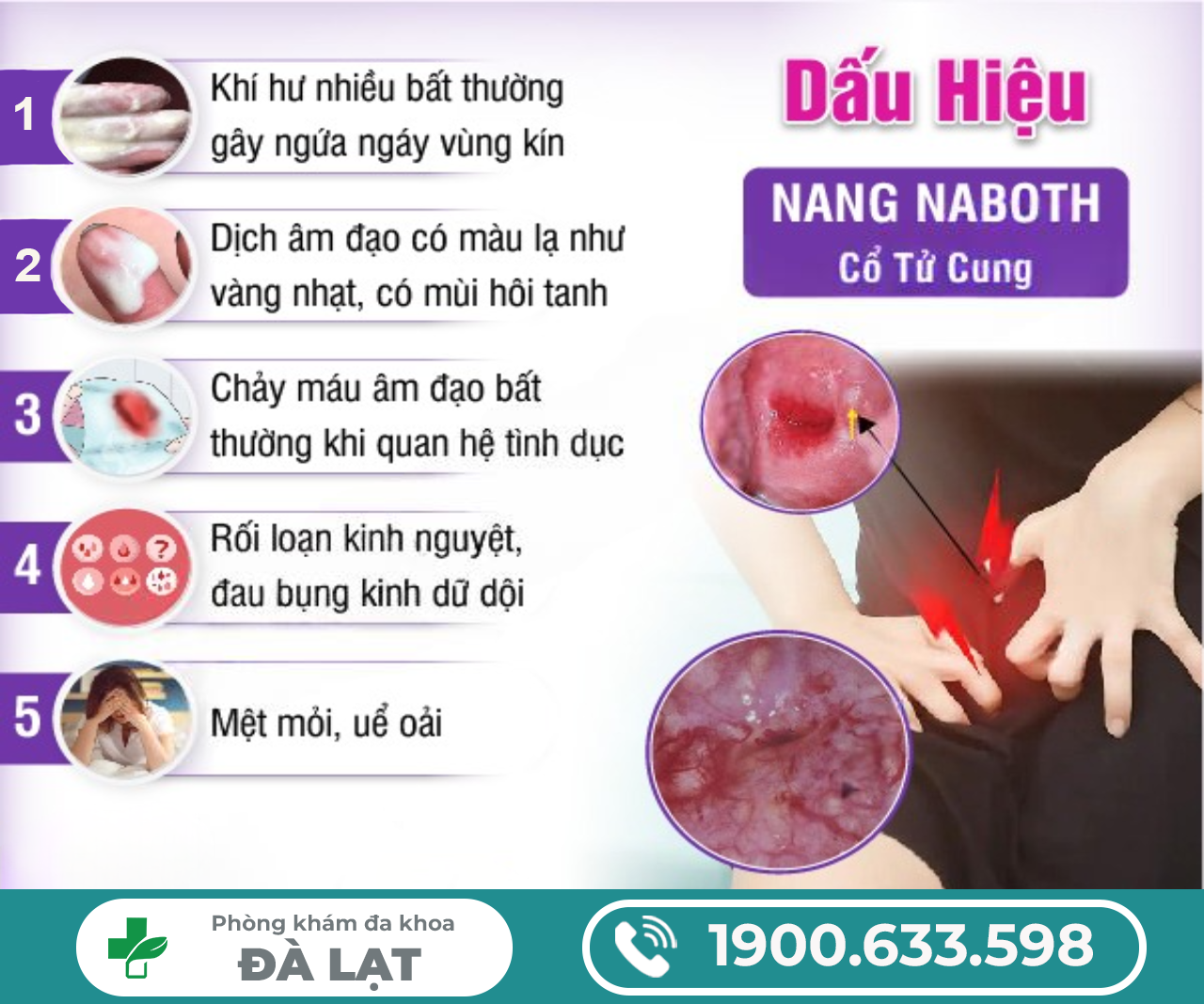 Hình ảnh minh họa